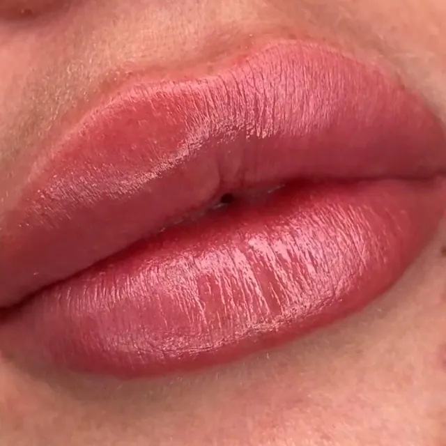 tratamiento labios